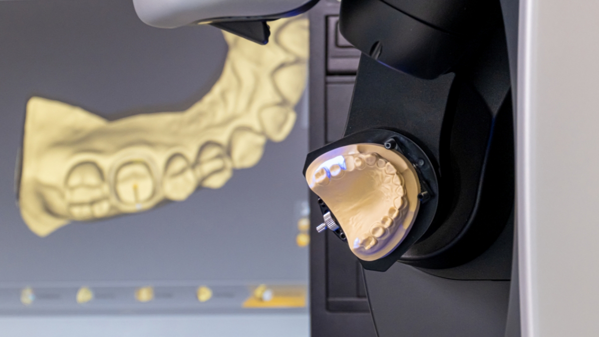 Digital dental manufacturing